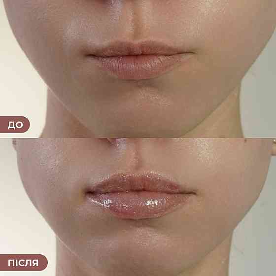 Бальзам-блеск для губ Sparkling Kiss Hillary 10 мл Киев