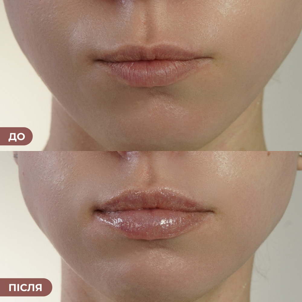 Бальзам-блиск для губ Sparkling Kiss Hillary 10 мл Київ - фото 4