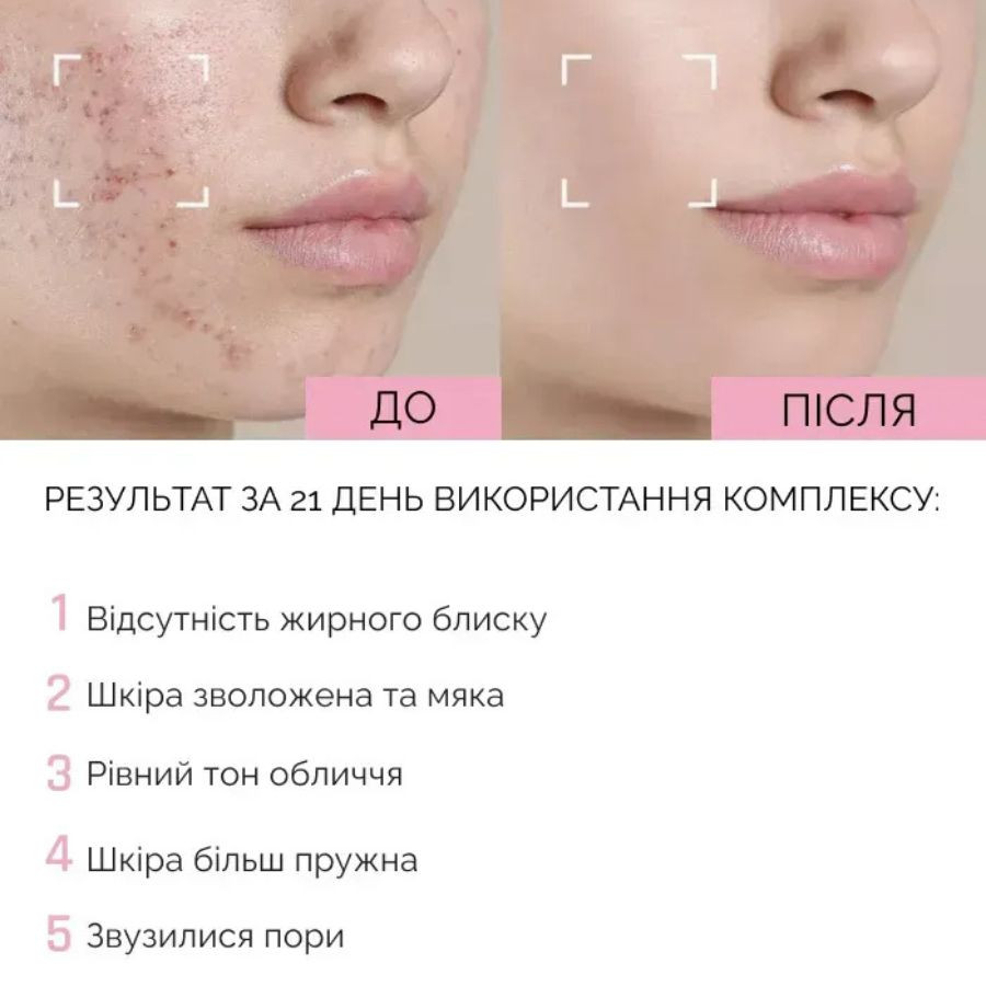 Увлажняющий тоник для лица с ниацинамидом Reclaire cosmetics 100 мл Киев - изображение 8