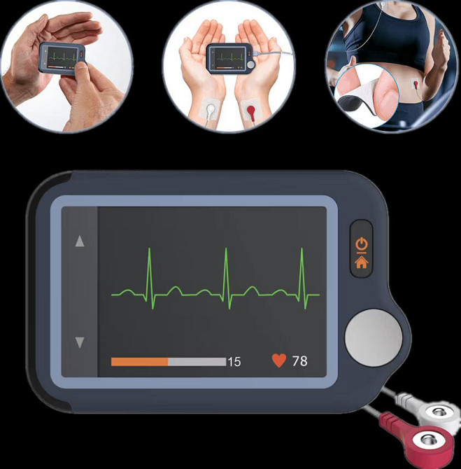 Кардіомонітор Wellue Checkme Plus Луцьк - фото 1