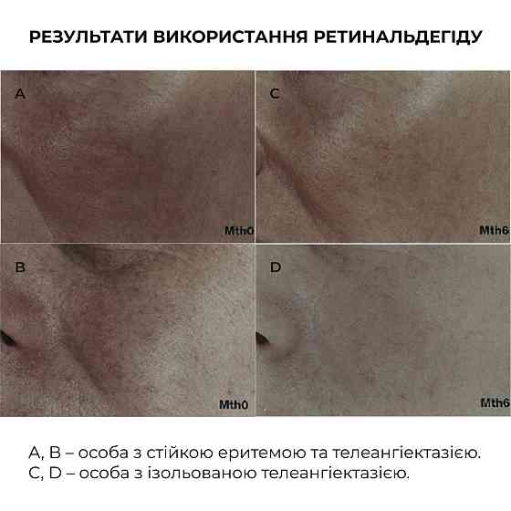 Нічна інтенсивна сироватка з ретиналем Night Intense Retinal Serum Hillary 30 мл Київ