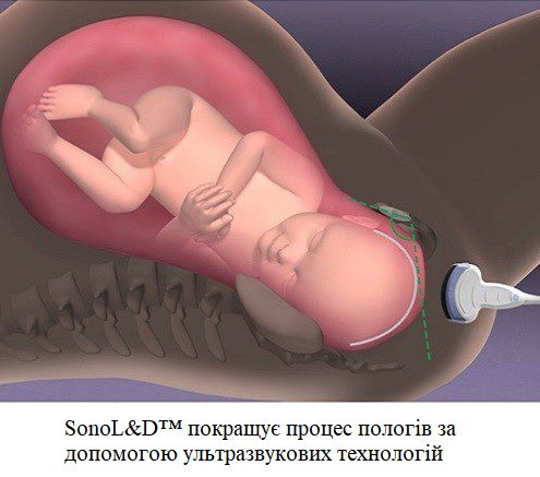 Ультразвуковий апарат (УЗД) Voluson™ SWIFT Дніпро - фото 6