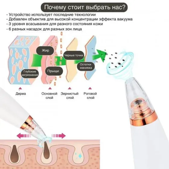 Вакуумный очиститель кожи и пор Multi-Functional для чистки лица Коломия