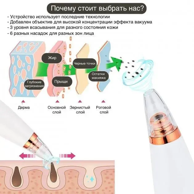 Вакуумный очиститель кожи и пор Multi-Functional для чистки лица Коломия - фото 4