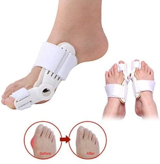 Фіксатор валгус на Стопу для Кісточки Великого Пальця, 1шт/уп Clefers білий Вінниця - фото 2