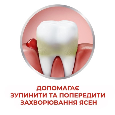 Зубная паста Parodontax Свежесть трав 75 мл (5054563064240/5054563949615) Винница - изображение 4