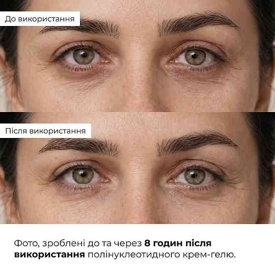 Набор для успокоения кожи и уменьшения признаков усталости вокруг глаз Hillary Soothing Skin & Tired Eye Care Set Киев