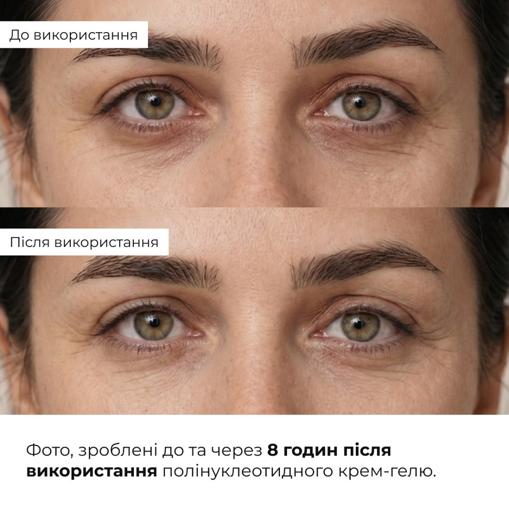 Набор для успокоения кожи и уменьшения признаков усталости вокруг глаз Hillary Soothing Skin & Tired Eye Care Set Киев - изображение 2