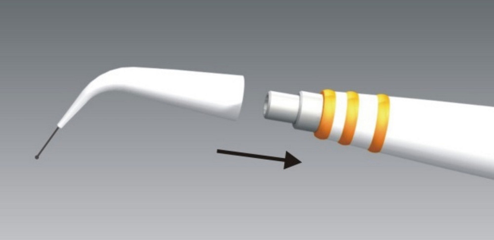 Пародонтальний зонд pa-on, OrangeDental Дніпро - фото 9