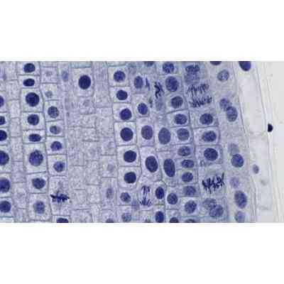 Набір мікропрепаратів Bresser високоякісних 10 шт (5984500) (931509) Вінниця