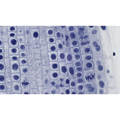 Набір мікропрепаратів Bresser високоякісних 10 шт (5984500) (931509) Вінниця - фото 4