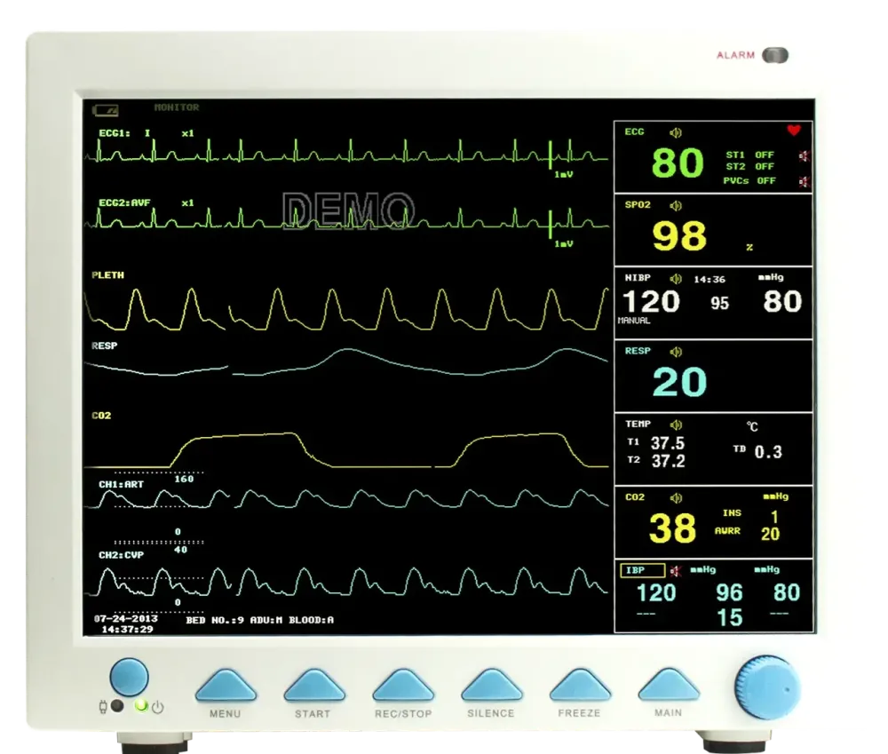 Монітор пацієнта Heaco G3D Дніпро - фото 2