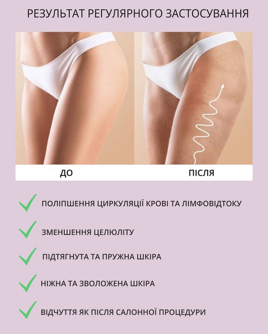 Топ-набір з 5 антицелюлітних обгортань+5 пар штанів для обгортання Reclaire cosmetics Київ - фото 10