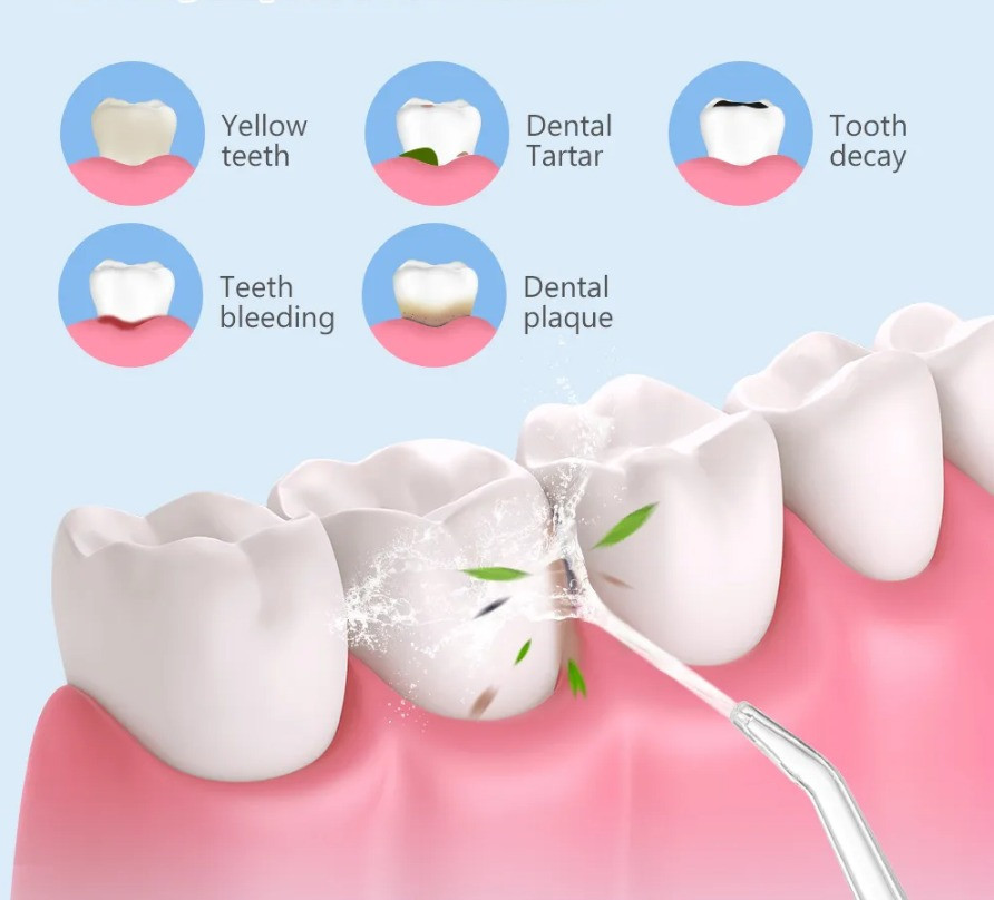 Портативный ирригатор для полости рта 8851 Днепр - изображение 2