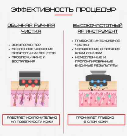 Мікротоковий масажер для обличчя Rejuvenayion beauty device D919 рожевий Київ