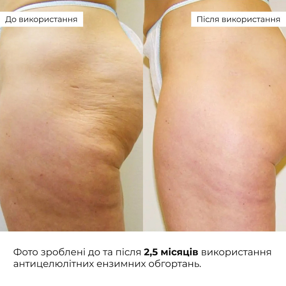 Комплекс Антицеллюлитных энзимных обертываний Hillary Anti-cellulite Bandage Zymo Cell (10 уп,) Киев - изображение 14