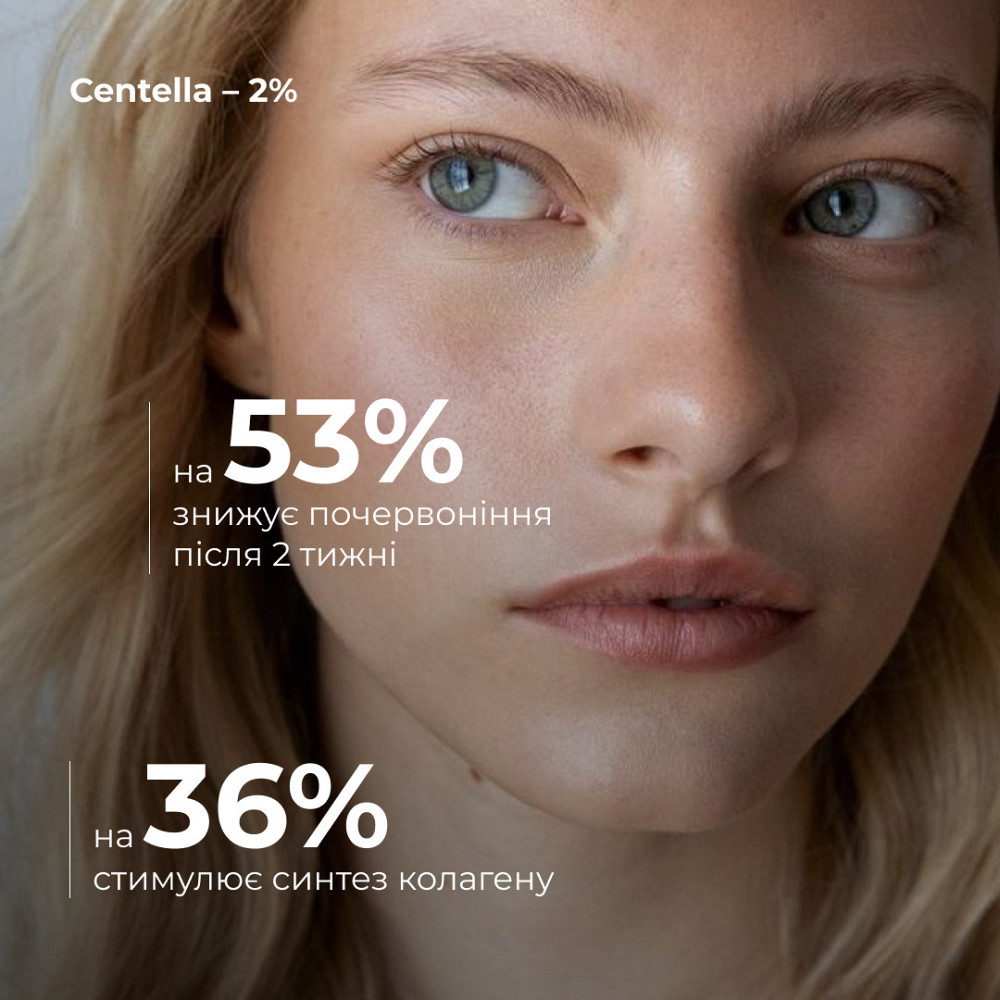 Набор для успокоения и увлажнения кожи с центеллой Hillary Centella Calm & Hydrate Set Киев - изображение 4