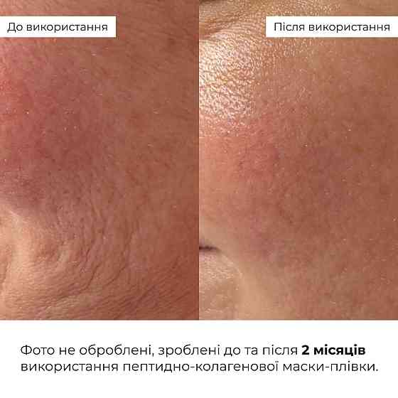 Пептидно-колагенова маска-плівка Collagen & Peptide Lifting Mask (Pink Edition) Hillary 90 мл Київ