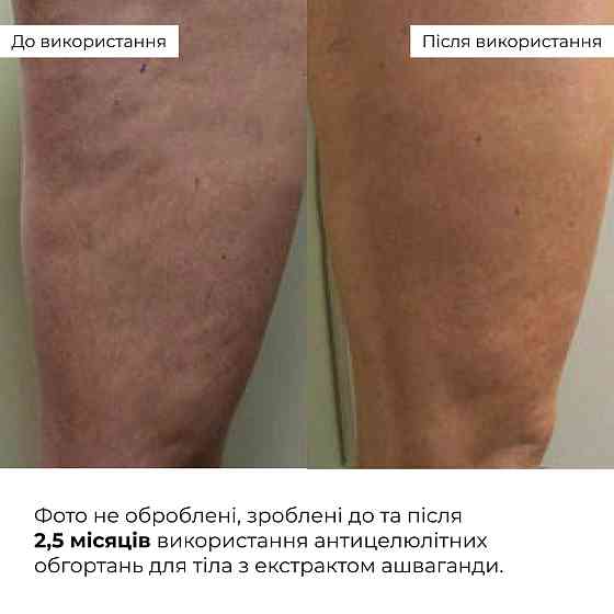 Курс антицелюлітних моделюючих обгортань з екстрактом ашваганди Ashwagandha Hot Slim Hillary (6 уп.) Київ