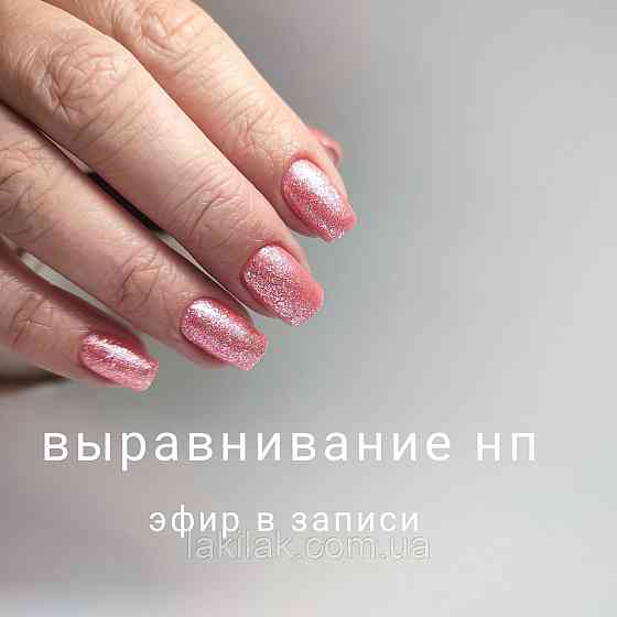 Вирівнювання нігтьової пластини (запис ефіру) Херсон