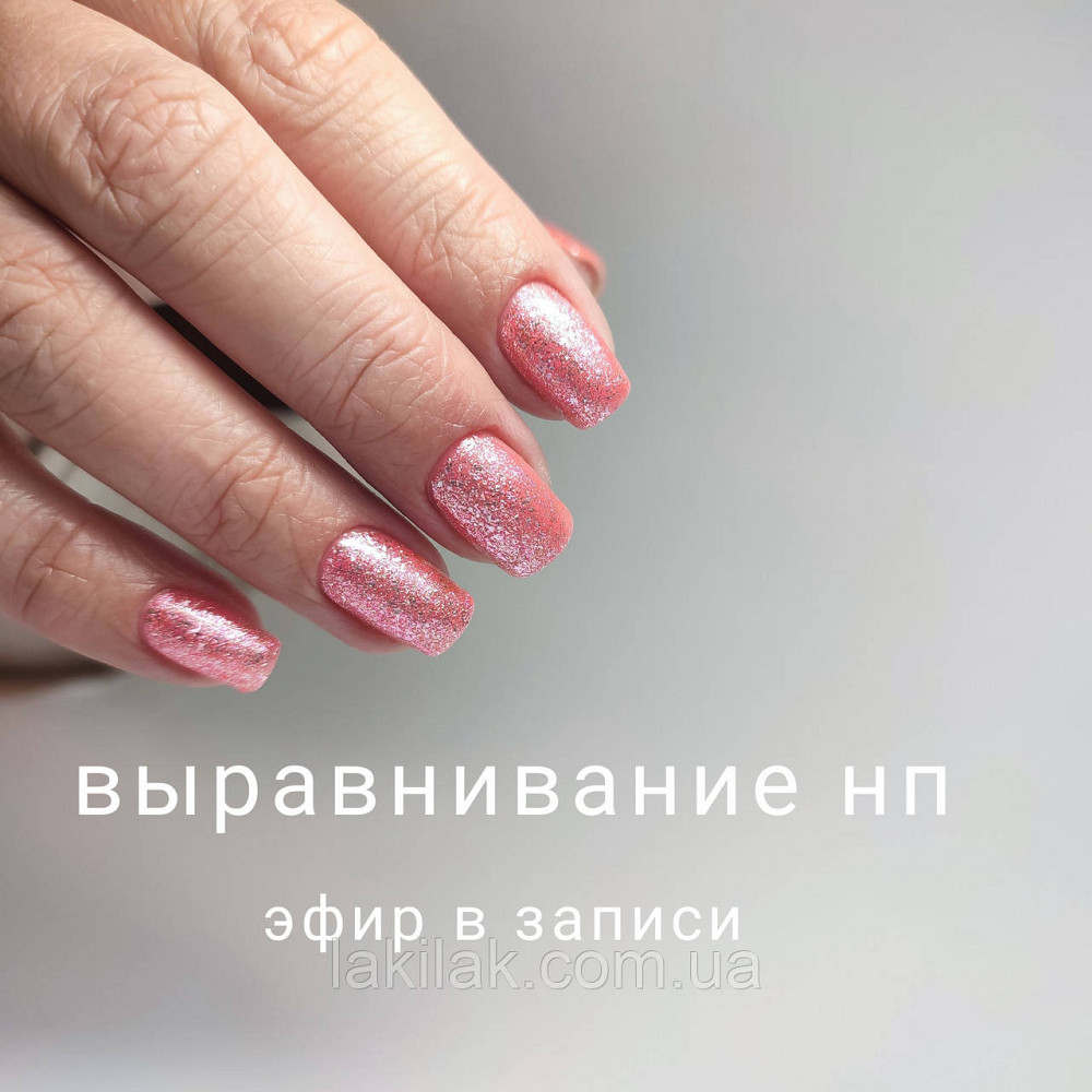 Вирівнювання нігтьової пластини (запис ефіру) Херсон - изображение 1