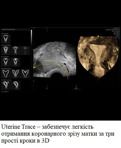 Ультразвуковий апарат (УЗД) Voluson™ S10 Дніпро - фото 5