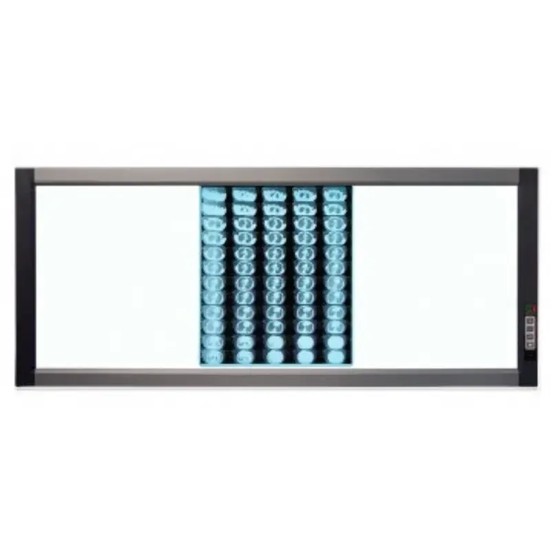 Світлодіодний медичний негатоскоп WL-3D Дніпро - фото 1