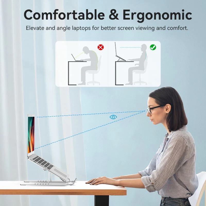 Підставка для ноутбука Laptop X-type Stand Silver Aluminum Alloy Vention Винница - изображение 8