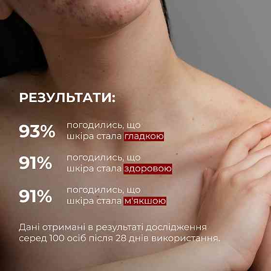 Комплекс для тела от акне с салициловой кислотой Hillary Anti-Acne Body Care Complex with Salicylic Acid Киев