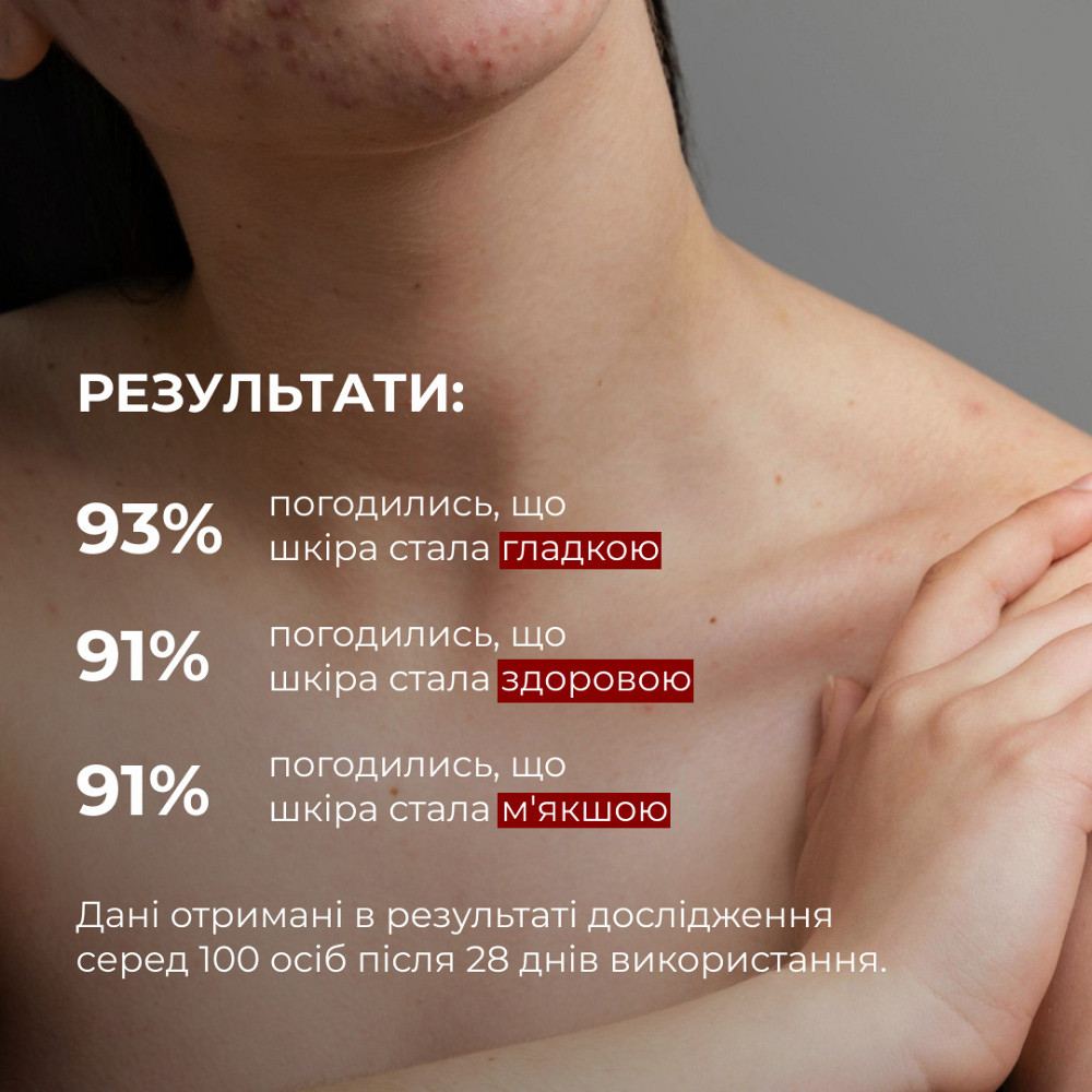 Комплекс для тела от акне с салициловой кислотой Hillary Anti-Acne Body Care Complex with Salicylic Acid Киев - изображение 2