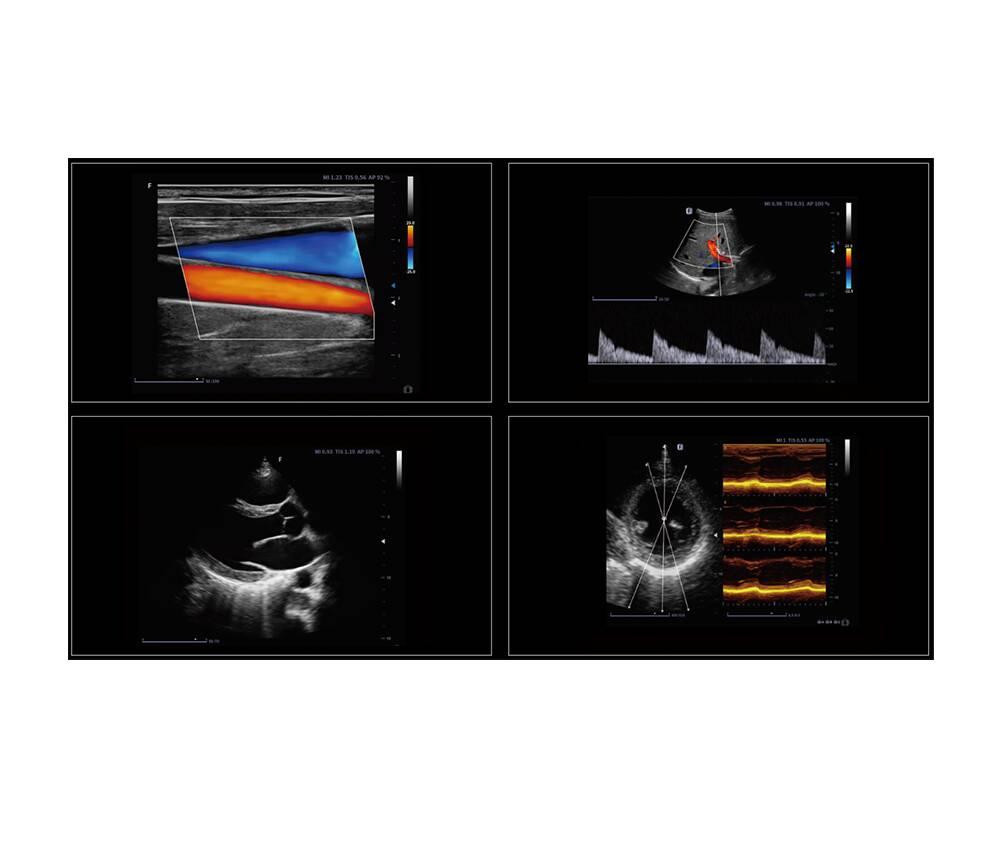 Ультразвукова діагностична система портативна експертного класу +2 датчики Finus 70 Focus & Fusion Дніпро - фото 2
