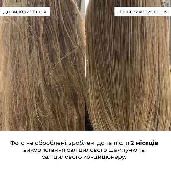 Саліциловий кондиціонер для відновлення волосся Salicylic Hair Reset Conditioner Hillary 400 мл Вінниця