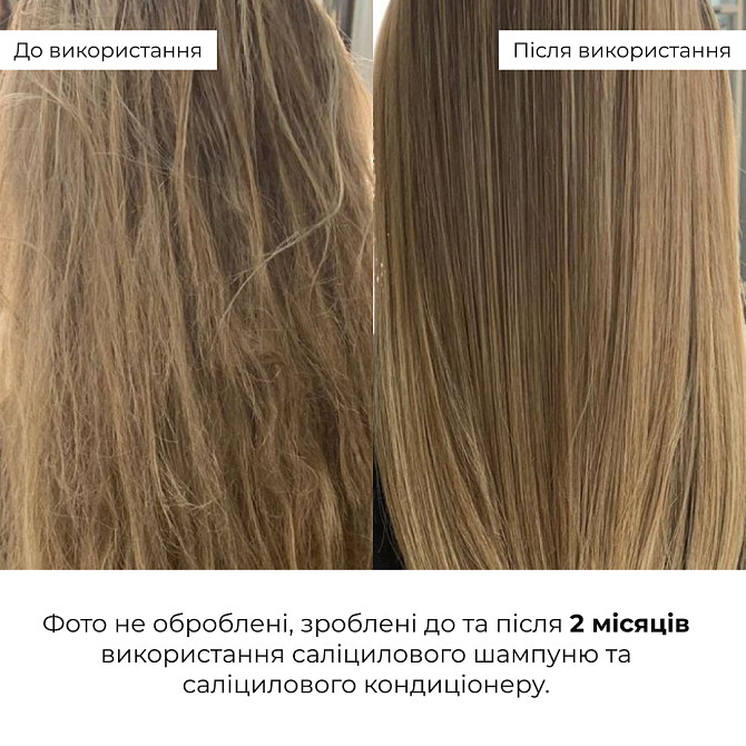 Салициловый кондиционер для восстановления волос Salicylic Hair Reset Conditioner Hillary 400 мл Винница - изображение 2