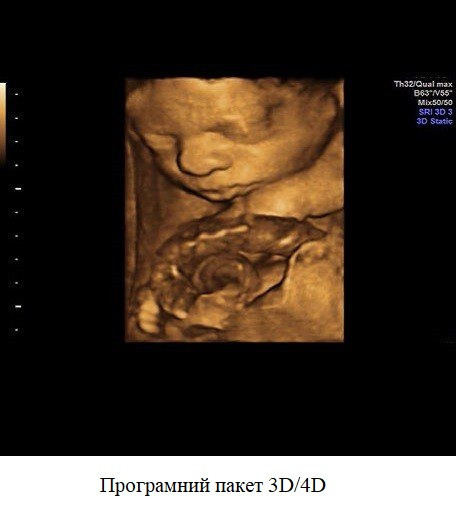 Ультразвуковий апарат (УЗД) Voluson™ S10 Дніпро - фото 9