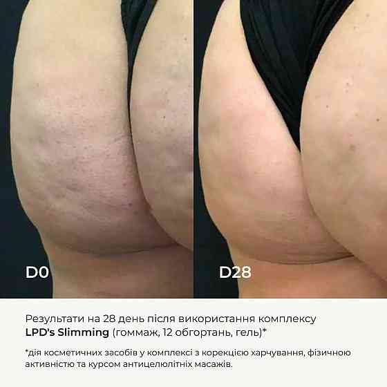 Набір вакуумних банок для тіла + Антицелюлітні засоби LPD's Slimming Київ