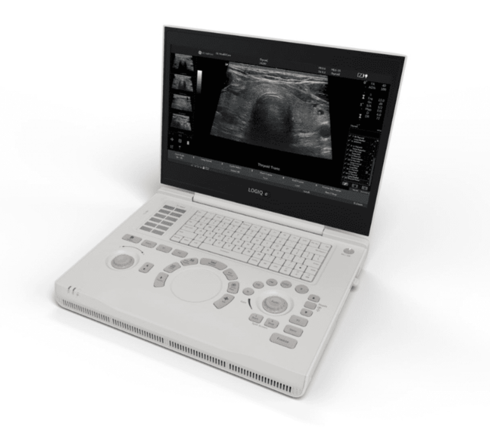 Портативний ультразвуковий апарат (УЗД) LOGIQ™ e Дніпро - фото 1