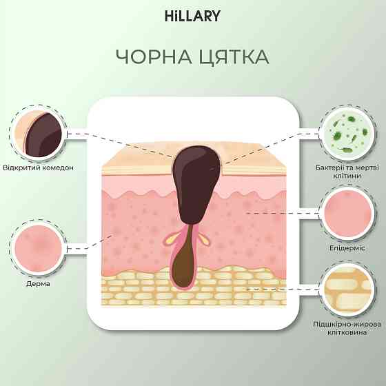 Набір для живлення та зволоження жирної шкіри восени Autumn nutrition and hydration for oil skin Hillary Київ