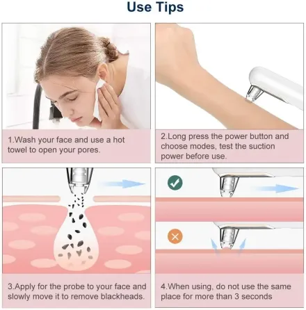 Вакуумный очиститель пор для лица Yobun Y2 от черных точек, 5 уровней мощности, 3 насадки, до 60 кПа Киев
